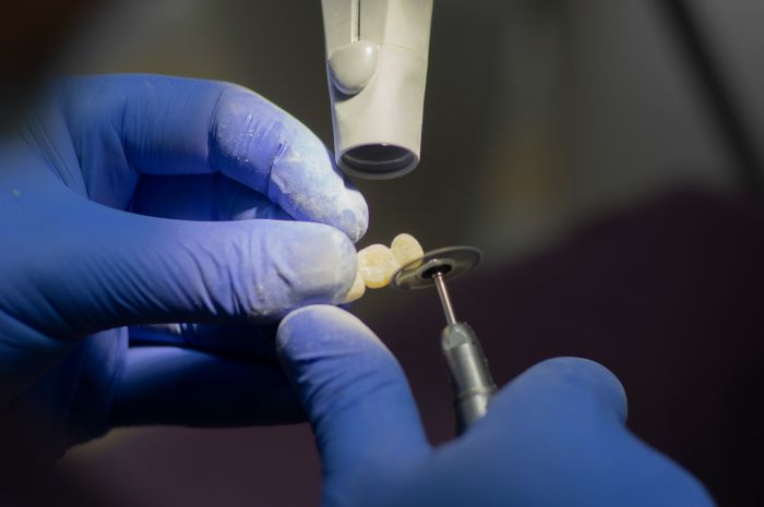 Zubní implantáty fotka